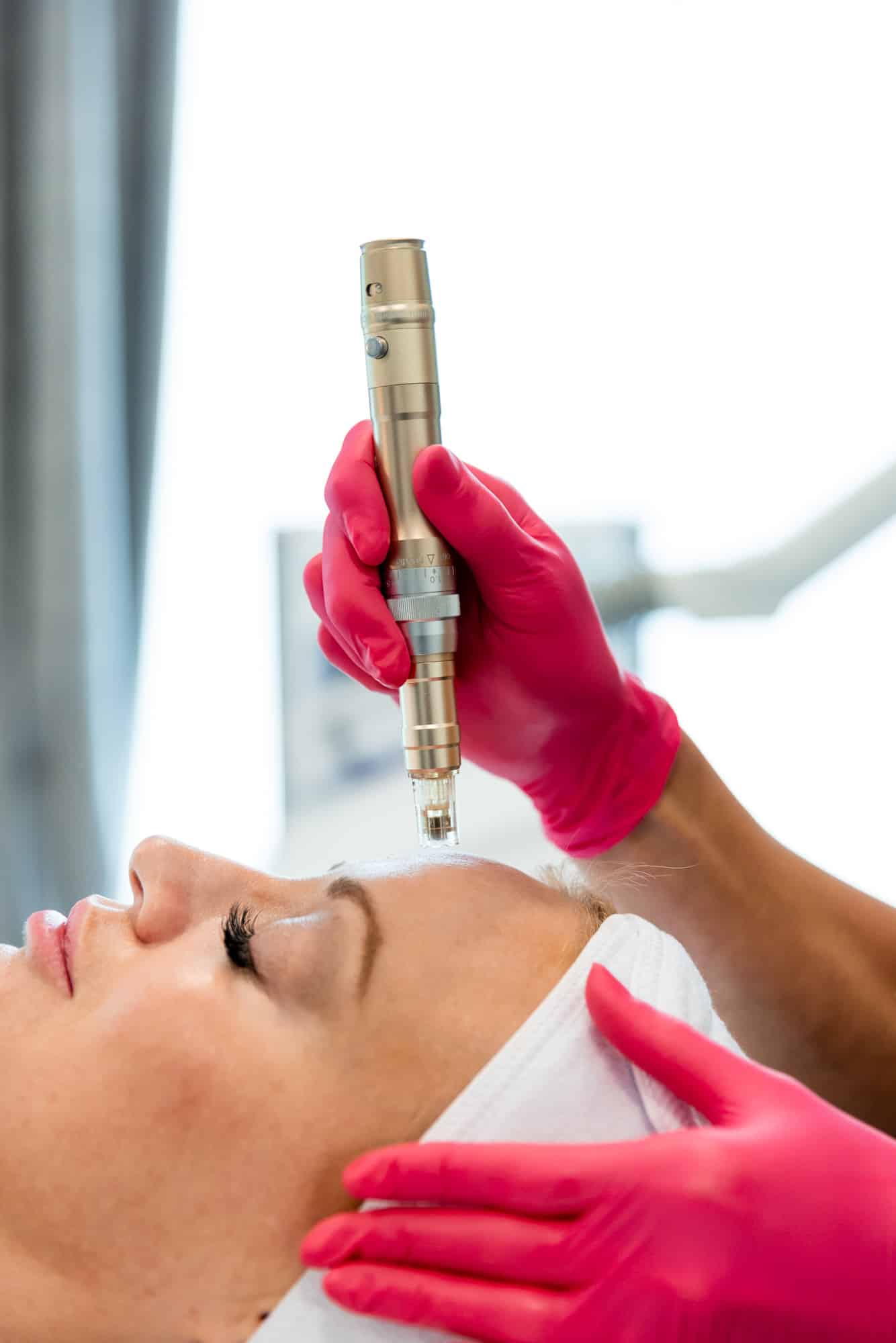 Is Profound Microneedling Right for You? Take the Quiz!